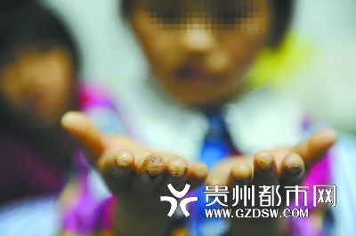 指尖被針扎得傷痕累累。