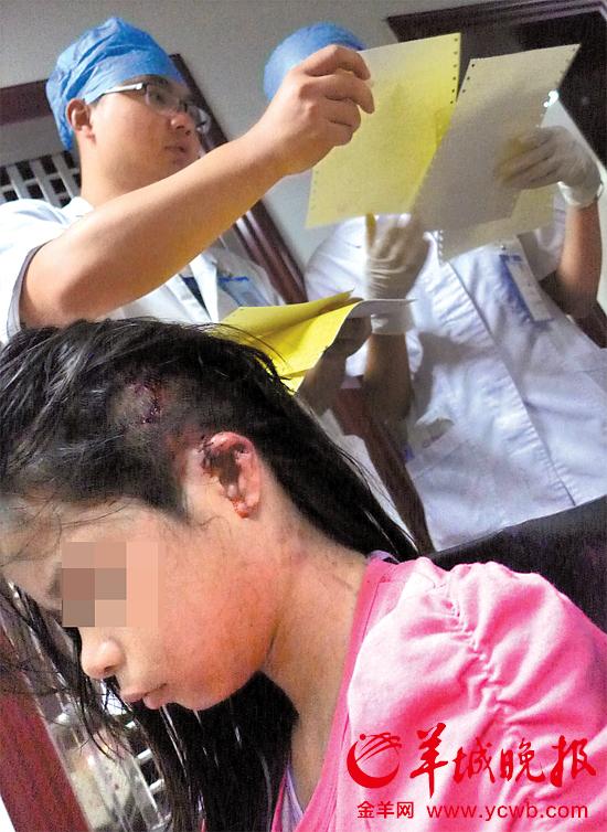 受傷的11歲女孩頭發(fā)被卷入扶梯，耳朵被嚴(yán)重拉傷，需手術(shù)。