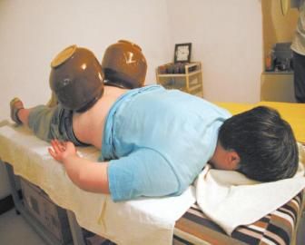 拔泡菜壇子火罐。