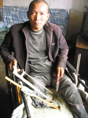 鄭艷良就是用這幾樣簡(jiǎn)陋工具，給自己做了右腿截肢手術(shù)。