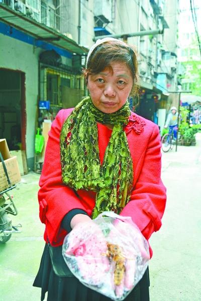 頭部受傷的黃女士展示兩根大魚刺。