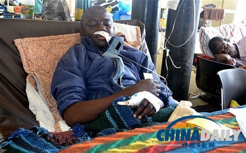 雖然已經(jīng)在醫(yī)院接受了近一個月的恢復(fù)治療，卡托卡的身體仍然非常虛弱。