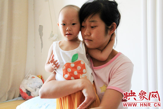 孩子和媽媽在一起，她的右眼已經(jīng)失明。