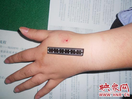 為幫助無證駕駛的朋友逃避處罰，新鄉(xiāng)的王某竟對執(zhí)勤民警大打出手，還將一名民警的手臂咬傷
