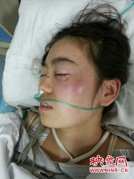 9月10日晚,被暴打的小陳出現(xiàn)了間歇性昏迷,被送進了省人民醫(yī)院。