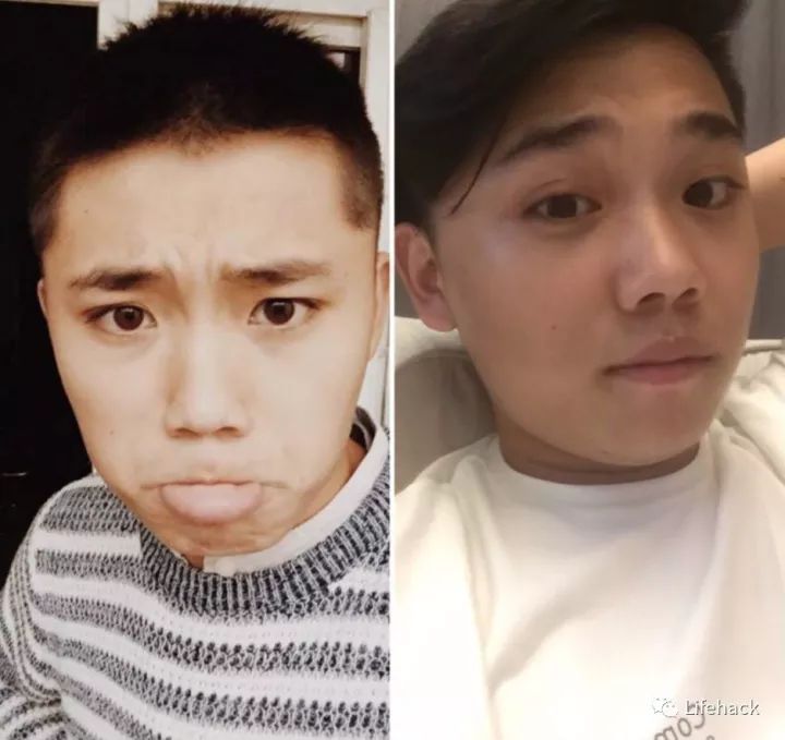 長胖20斤，臉型怎么變？這些例子看完扎心了！