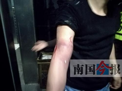 覃先生手臂被卡的部位受傷流血，所幸傷勢(shì)無大礙。 通訊員 王建民 攝