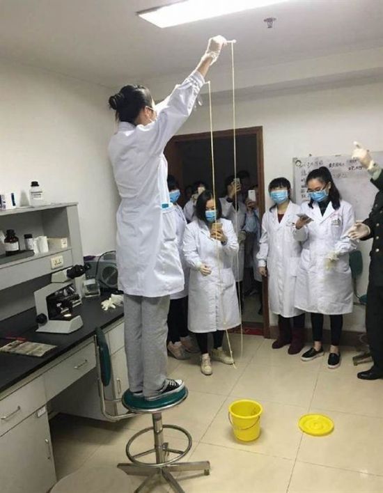 愛(ài)吃生肉惹的禍！男子體內(nèi)取出5米長(zhǎng)寄生蟲(chóng)(圖)