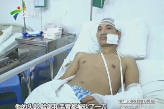 另一名傷者頭部、臉部和手臂都被砍了一刀。(視頻截圖)
