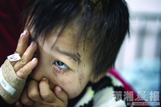 1月13日，湖南省兒童醫(yī)院，4歲的源源用手蒙住了眼睛。