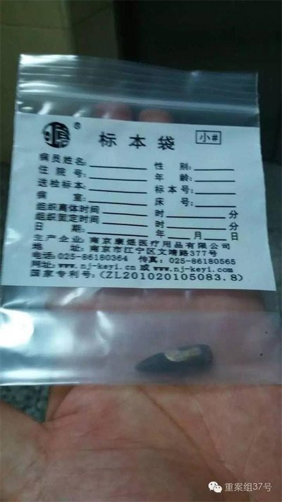 經(jīng)警方鑒定，秦女士體內(nèi)取出的子彈系56式步槍射出 。 受訪者供圖